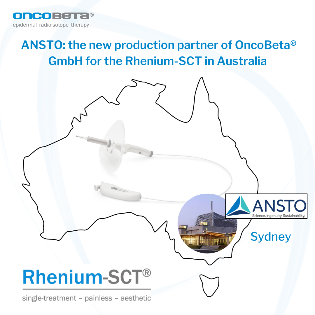 Map of australia displaying location of rhenium-sct production location