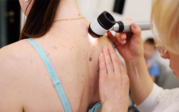 a patient's back being examined with a dermato scope