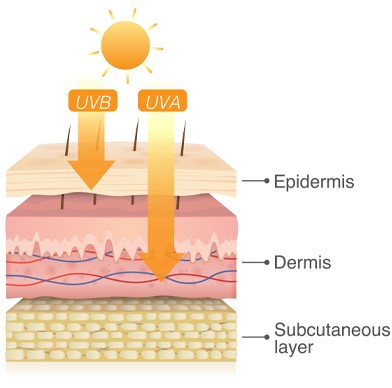 the effect of different types of UV radiation on our skin